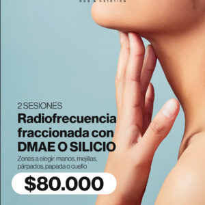 RADIO FRECUENCIA FRACCIONADA EN ZONAS FINAS 2 SESIONES
