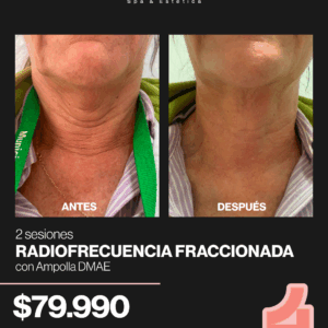 2 SESIONES DE RADIOFRECUENCIA FRACCIONADA EN PAPADA Y CUELLO