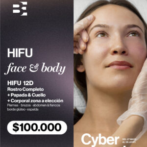 HIFU FACIAL Y CORPORAL 2X CYBER