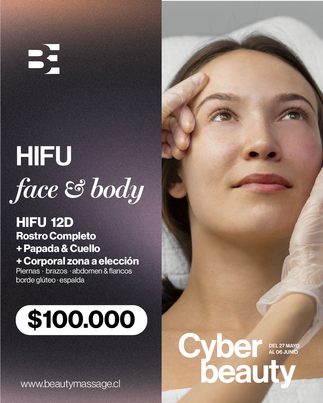 HIFU FACIAL Y CORPORAL 2X CYBER