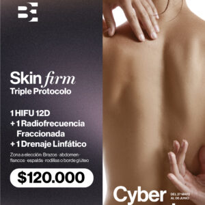 HIFU 12 + RADIOFRECUENCIA FRACCIONADA + DRENAJE LINFATICO