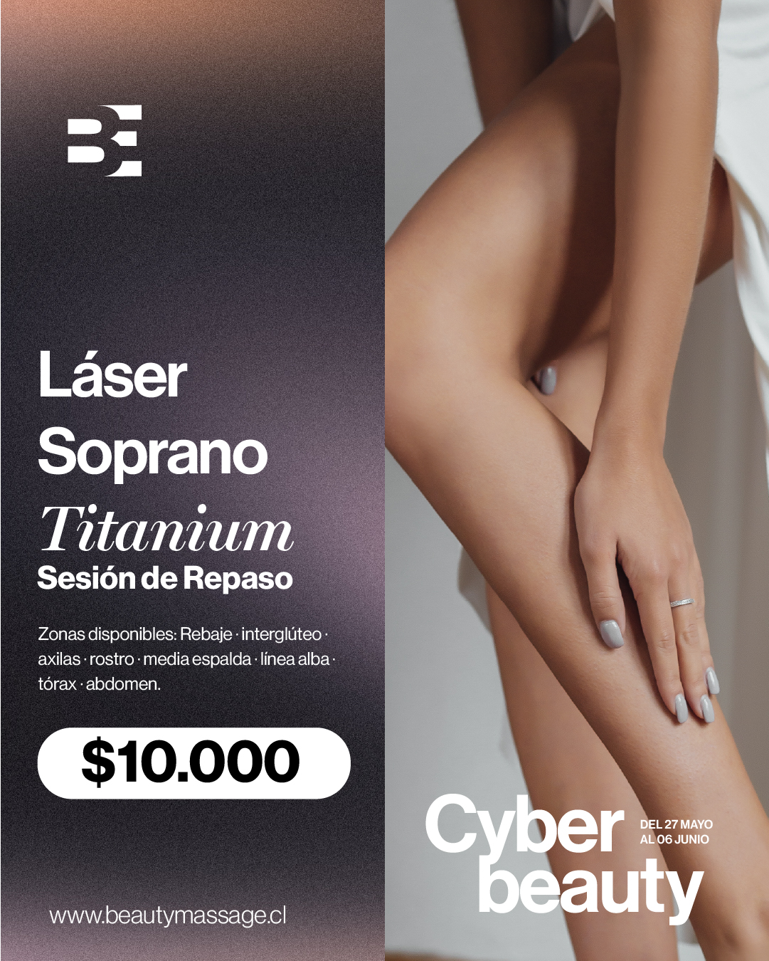 DEPILACION SOPRANO TITANIUM