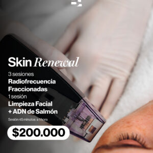 3 RADIOFRECUENCIA FRACCIONADA + ADN DE SALMON + LIMPIEZA FACIAL