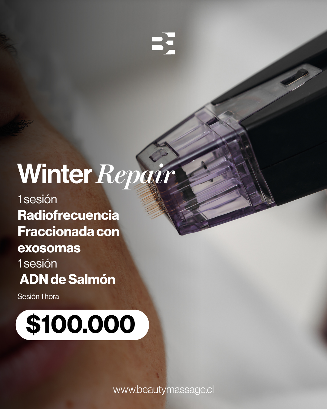 RADIOFRECUENCIA FRACCIONADA + EXOSOMAS + ADN DE SALMON+ LIMPIEZA FACIAL
