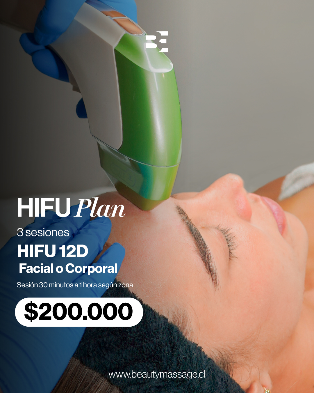 3 SESIONES DE HIFU FACIAL O CORPORAL
