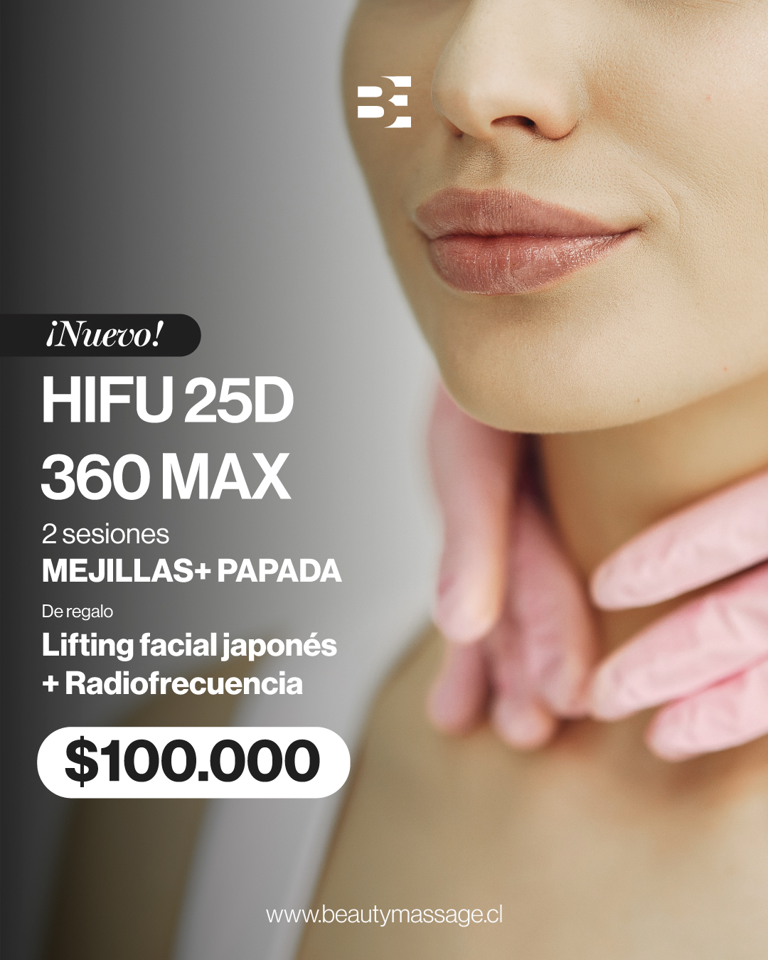 HIFU 25 360 MAX 2 SESIONES mejillas y papada