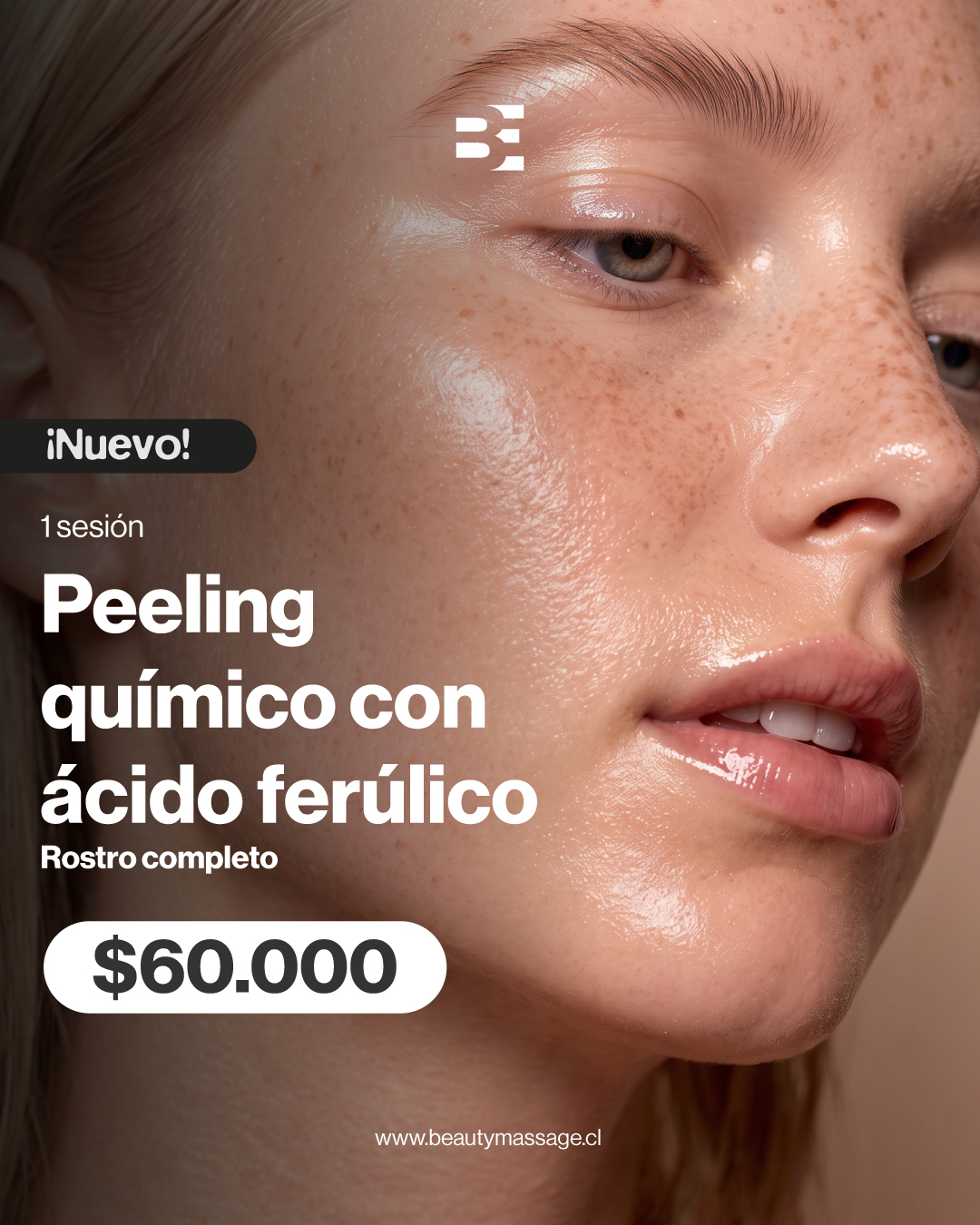 PEELING FERULICO GRADUAL