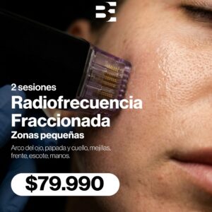 2 RADIOFRECUENCIA FRACCIONADA ZONAS CHICAS + AMPOLLA