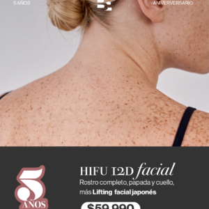 HIFU 12 rostro completo + papada y cuello